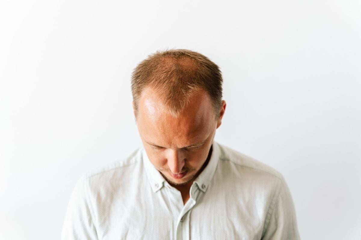 Getting before a hair transplant can be a life-changing decision for many people who suffer from hair loss or thinning. However, before you go ahead with the procedure, there are several crucial steps you should take to ensure the best possible outcome and a smooth recovery.