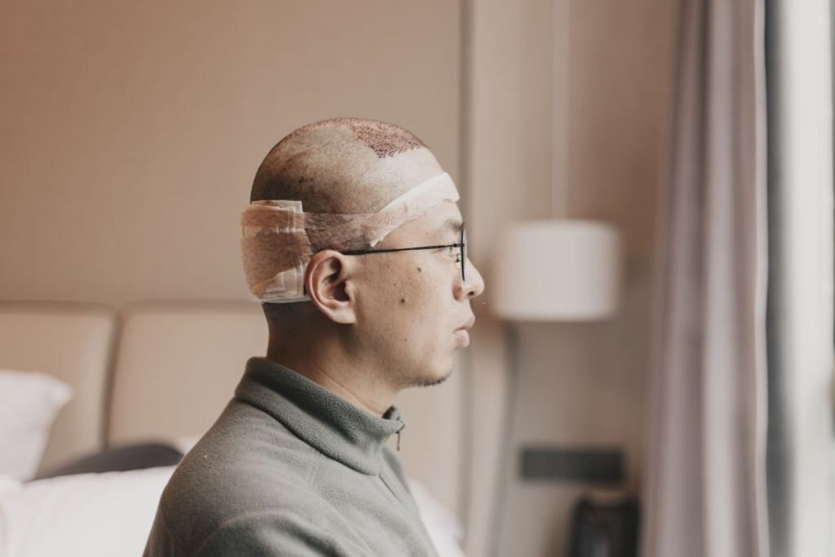 How To Sleep After Hair Transplant Soracamed Clinic