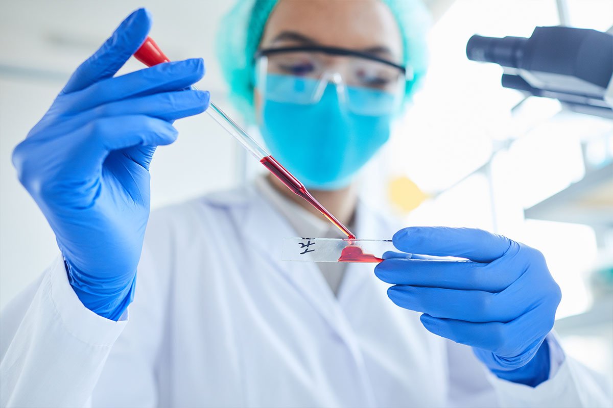 Bone Marrow Transplant Procedure, In the world of medical wonders has been regarded as a beacon of light for those suffering from serious hematological or non-hematological diseases. This thorough guide explains the complexities involved in bone marrow transplants from gaining a better understanding of the procedure to managing the healing process.