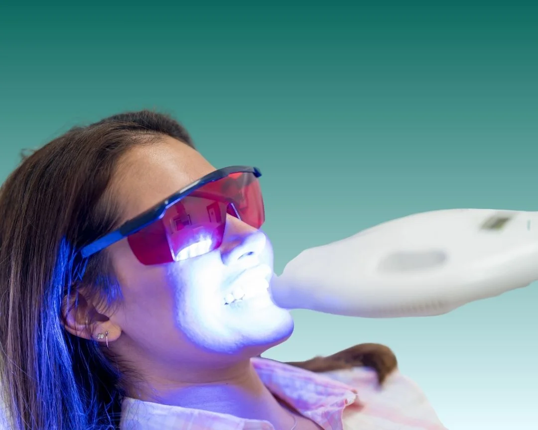 Teeth whitening Turkey 2025 Soraca Med
