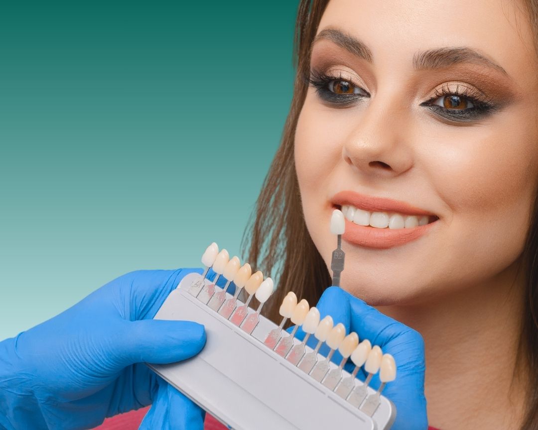 EMax Veneers Туреччина