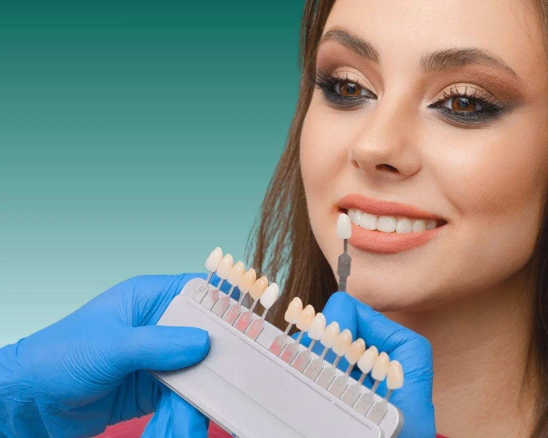 EMax Veneers Turkey 2025
