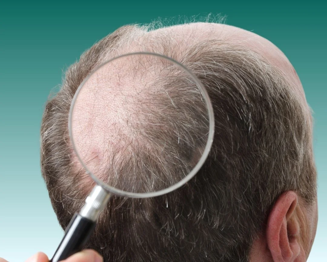 Hair Simulation in Turkey Antalya 2025