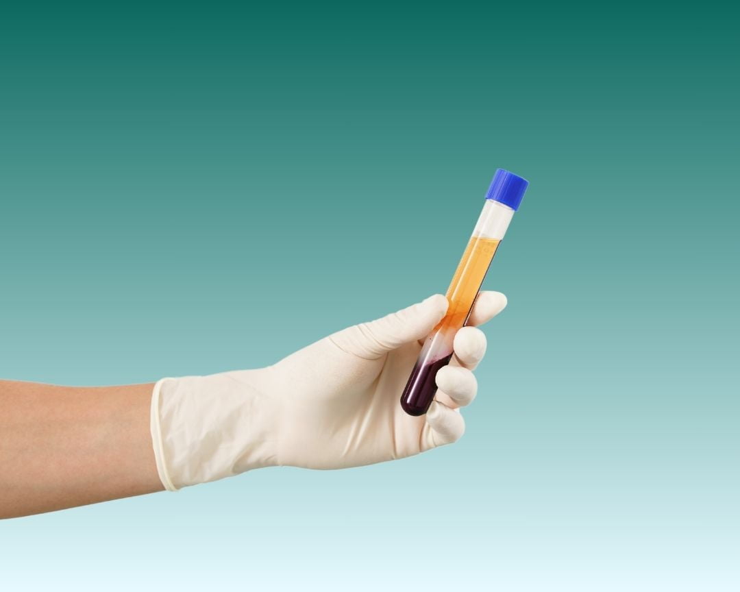Plasma ricco di piastrine Turchia Antalya