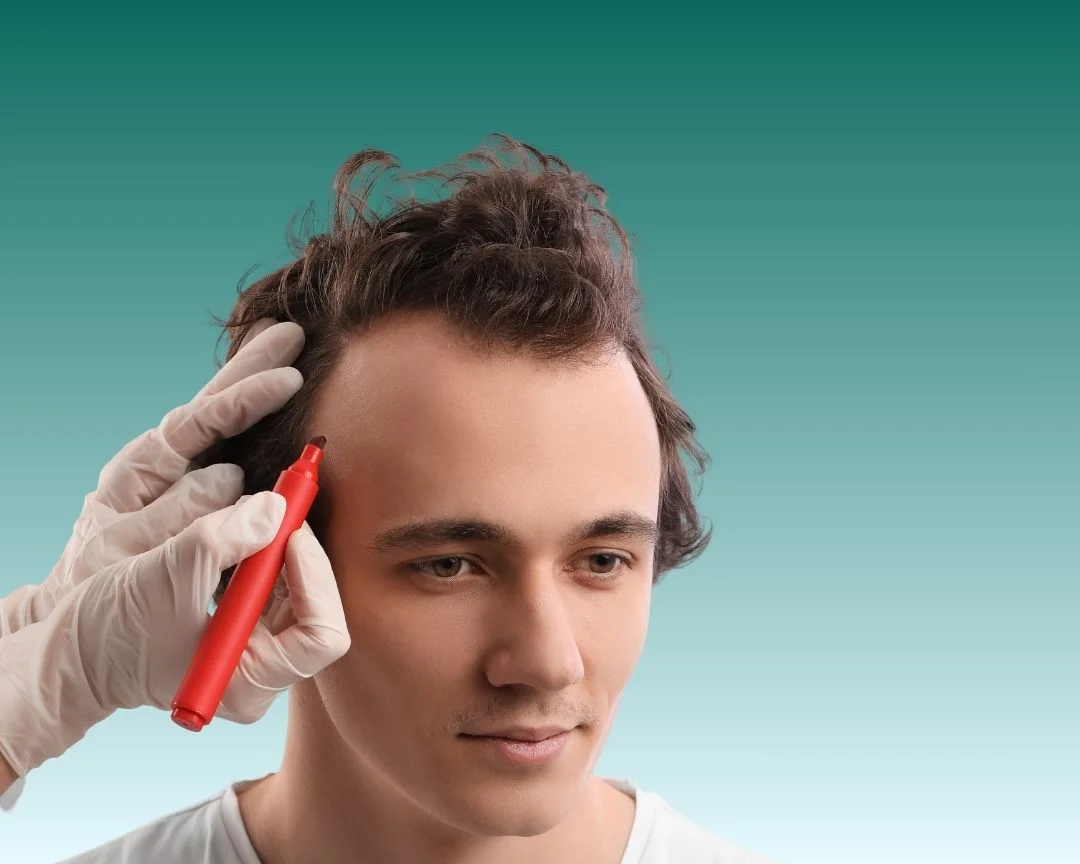 Sapphire FUE Hair Transplant 2025 Antalya Turkey