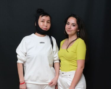 About Us 6 Jumagul Face And Neck Lift Happy Patients 2024