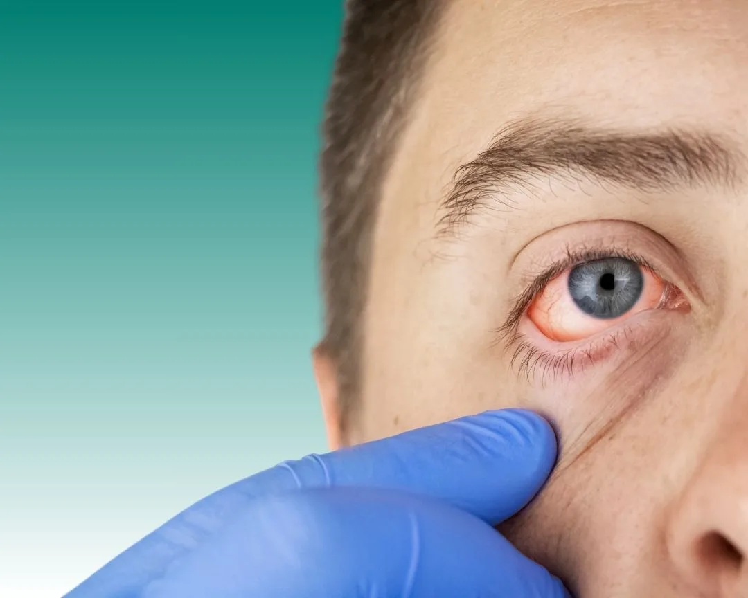 Tratamiento del glaucoma cerca de mí en 2026