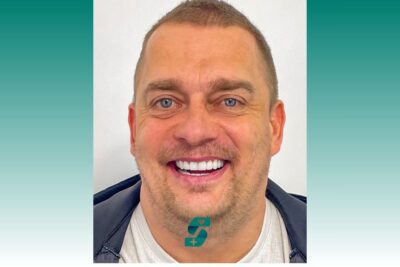 Dental Treatment in Antalya - Dental Clinic Antalya 2 What Is Full Mouth Dental Implants 2025