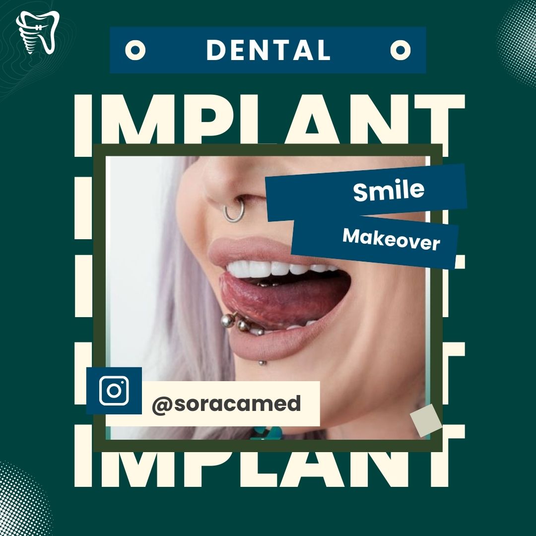 Tandbehandling i Antalya på tandklinikken Soraca Med