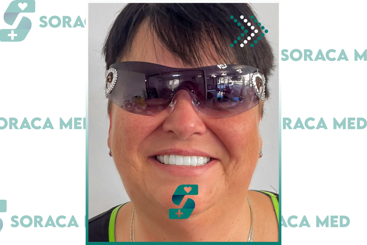 Zygomatic Implant in Antalya - Reviews, Cost, Procedure 2025 1 Zygomatic Implant Happy Patient 2025