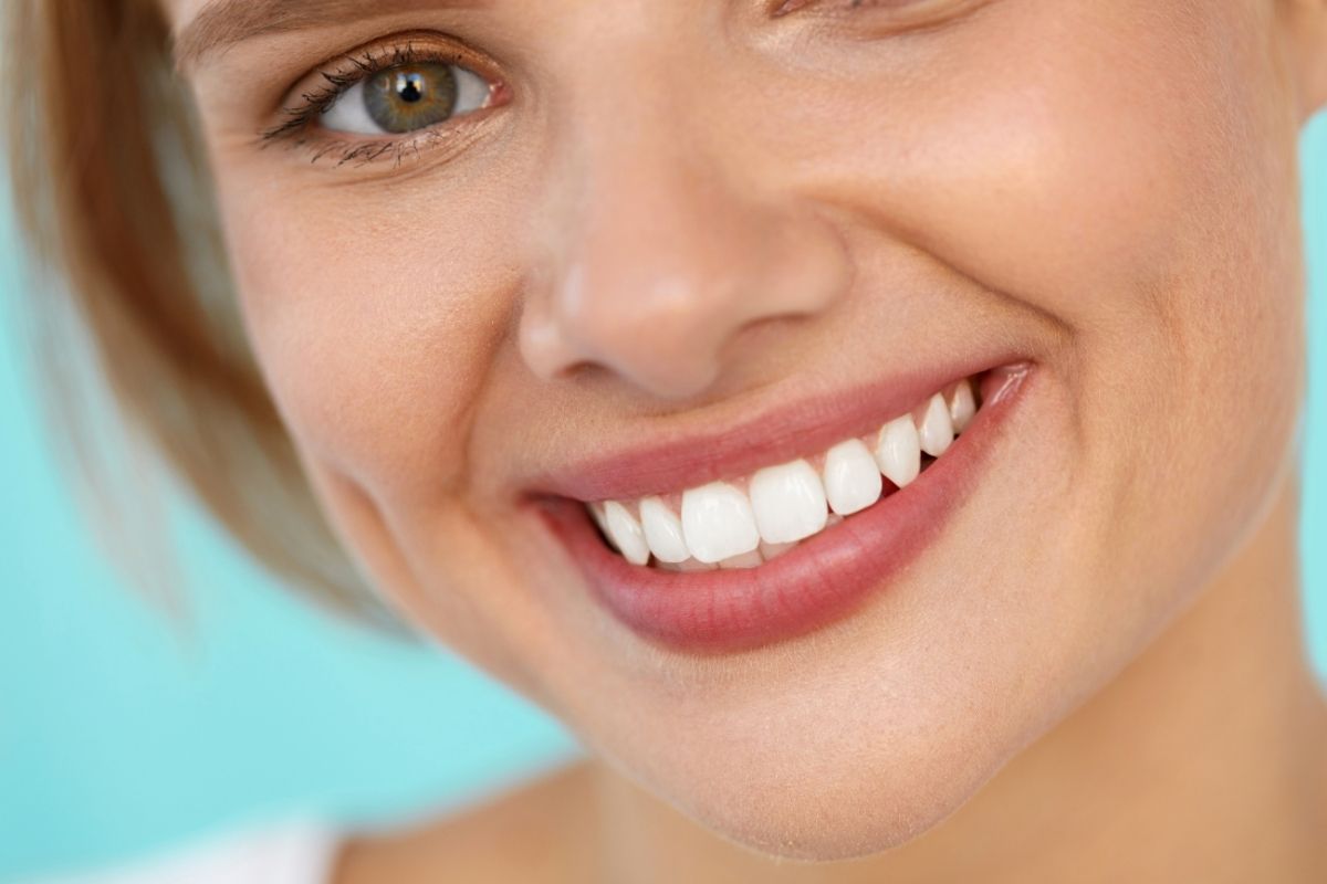 Teeth Whitening in Antalya Price & Cost, Reviews 2025 1 Teeth Whitening In Antalya Prices Cost Reviews 2025
