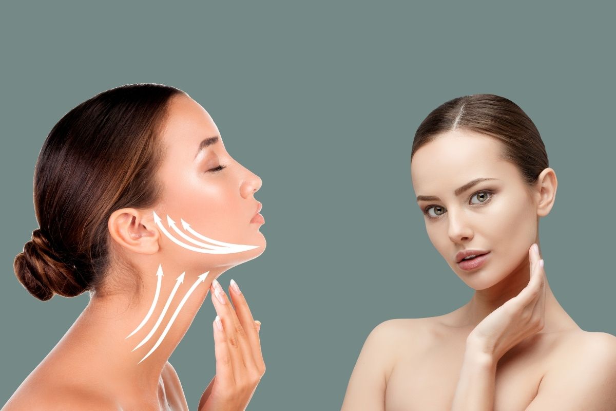 Face and Neck Lift in Antalya