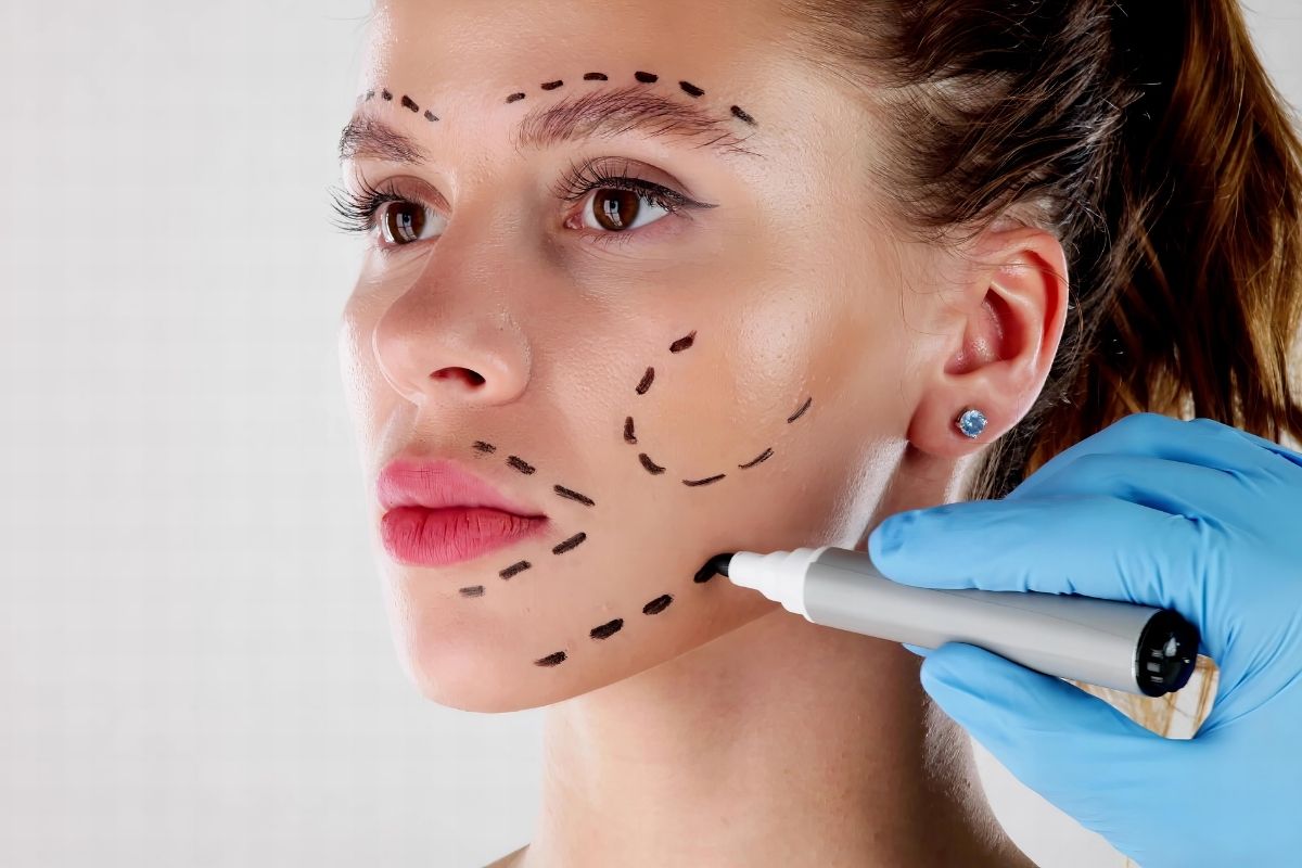Face and Neck Lift - Reviews, Cost, Prices 2025 1 Face Lift Surgery
