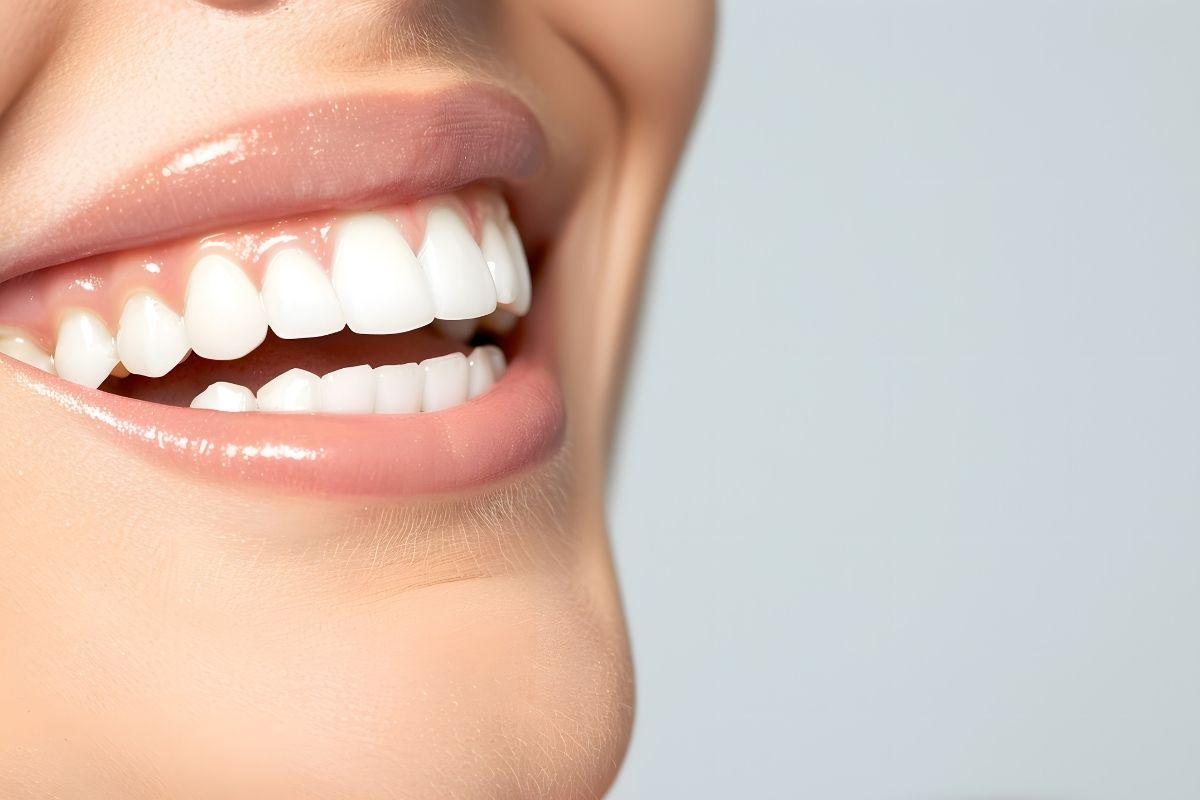 Dental Implant Cost In Antalya