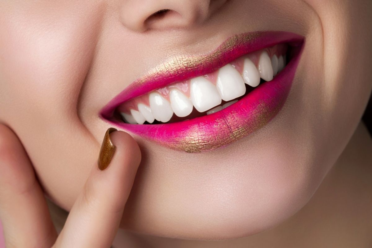 Hollywood Smile in Antalya