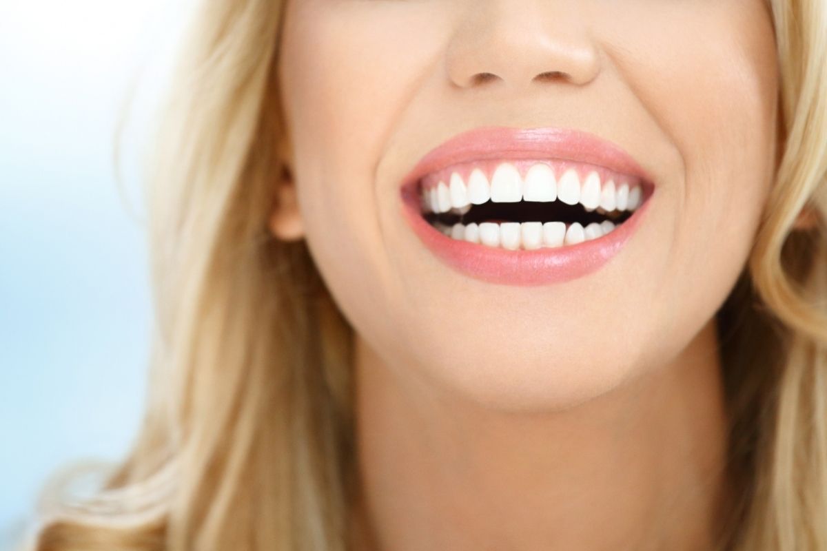 What Is Hollywood Smile