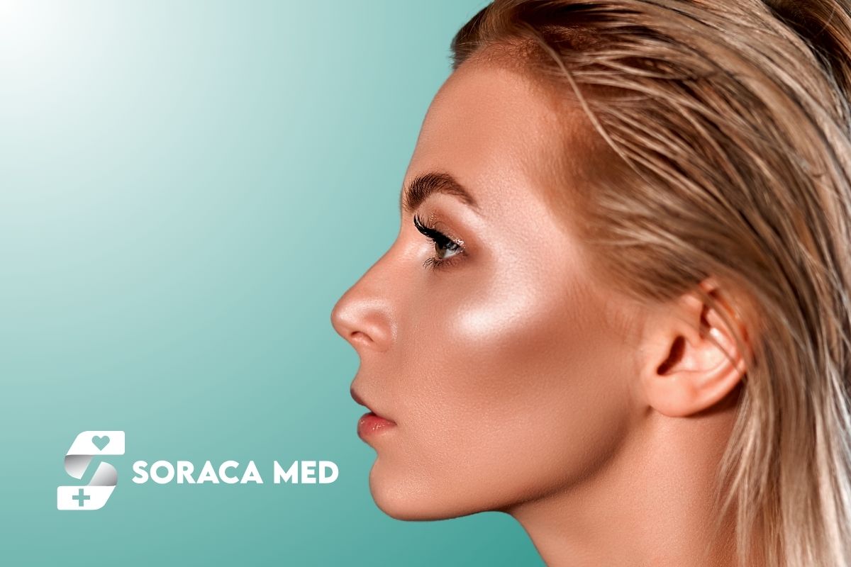 Riduzione delle ali nasali: procedura, risultati e recupero 1 Riduzione Delle Ali Nasali: Procedura, Risultati E Recupero