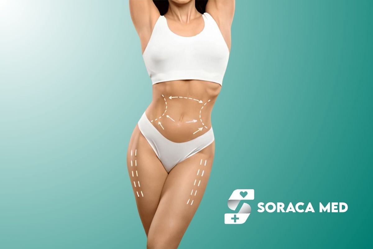 How Much Does Abdominal Etching