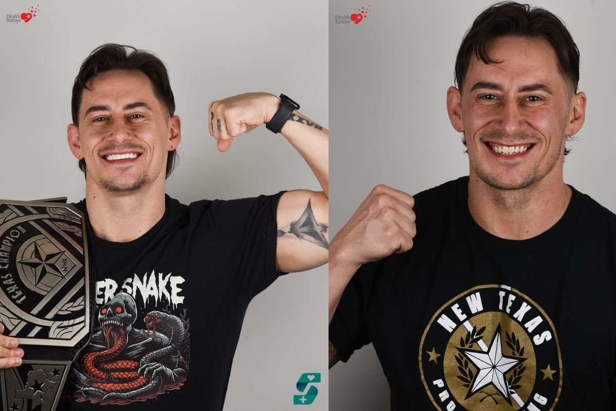 Implant zęba w Antalyi