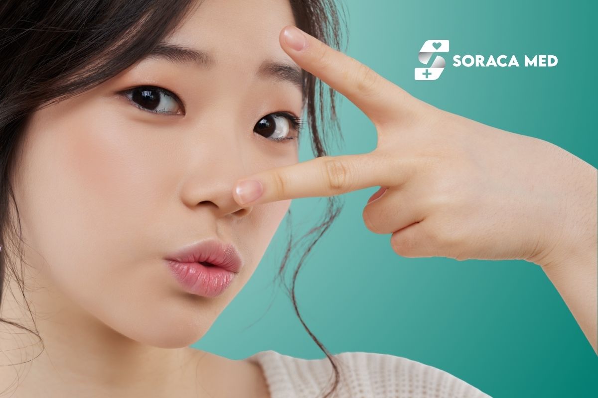 Riduzione delle ali nasali