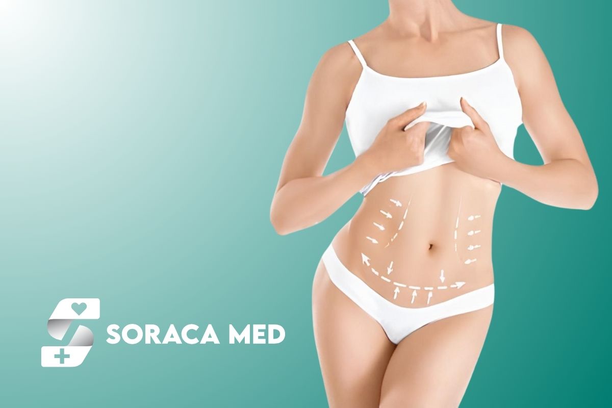 Tummy Tuck In Antalya, Turkey: Recovery, Scars &Amp; Results