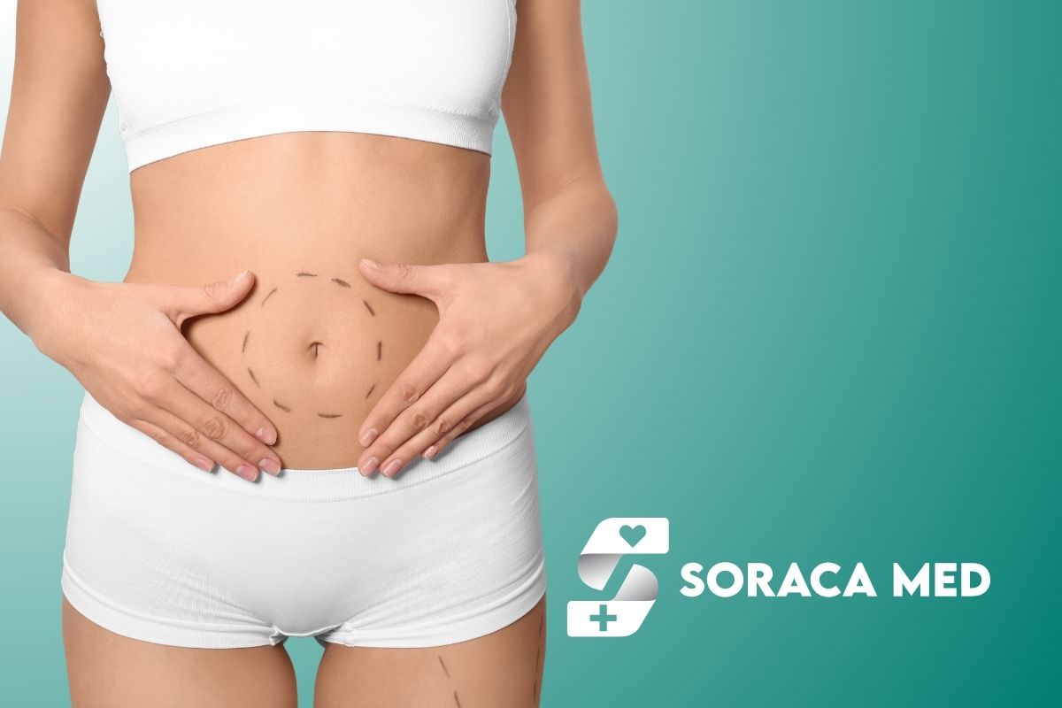 Tummy Tuck In Antalya, Turkey: Recovery, Scars &Amp; Results