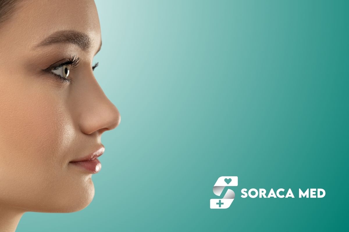 Riduzione delle ali nasali: procedura, risultati e recupero 2 Riduzione Delle Ali Nasali: Procedura, Risultati E Recupero