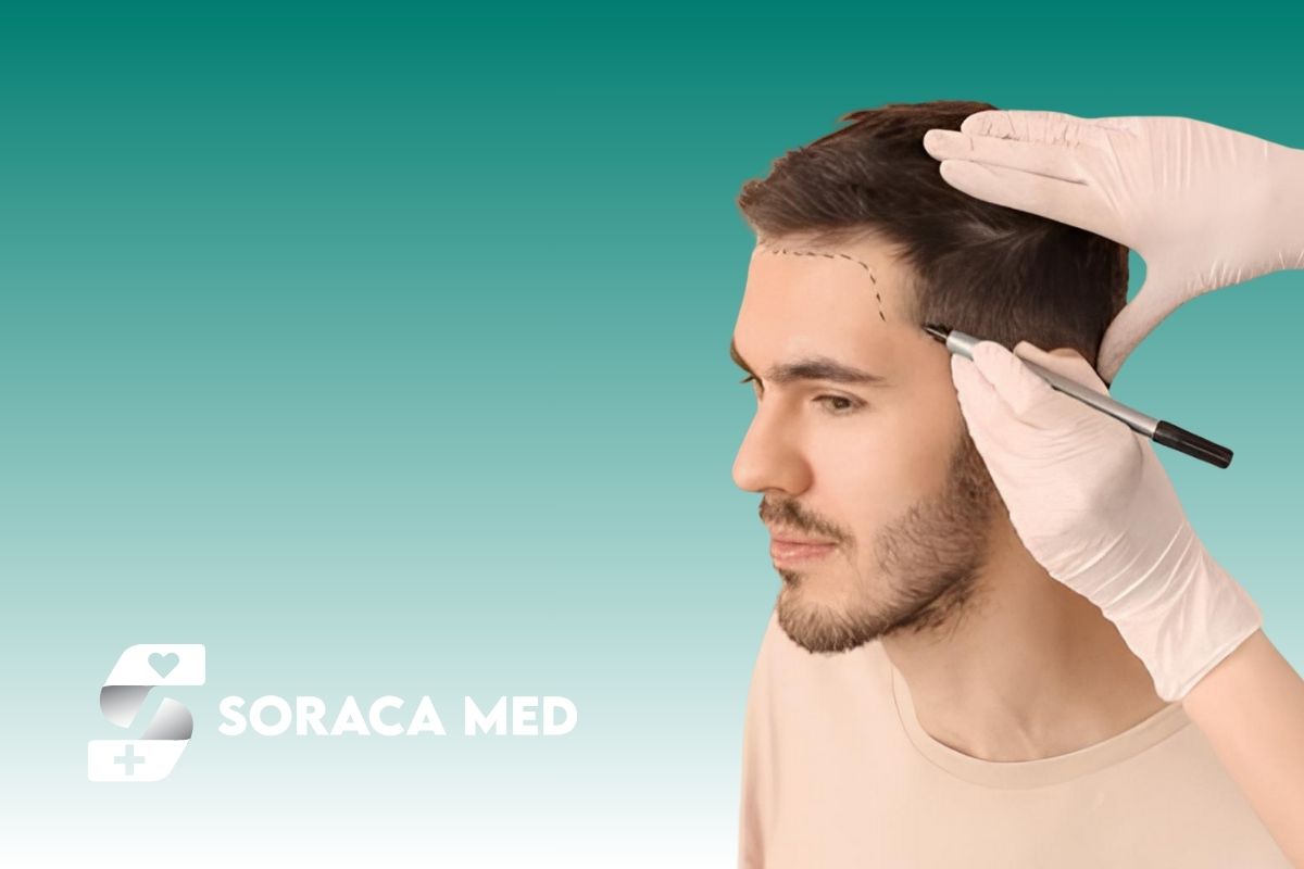 Fue Or Dhi Which Method