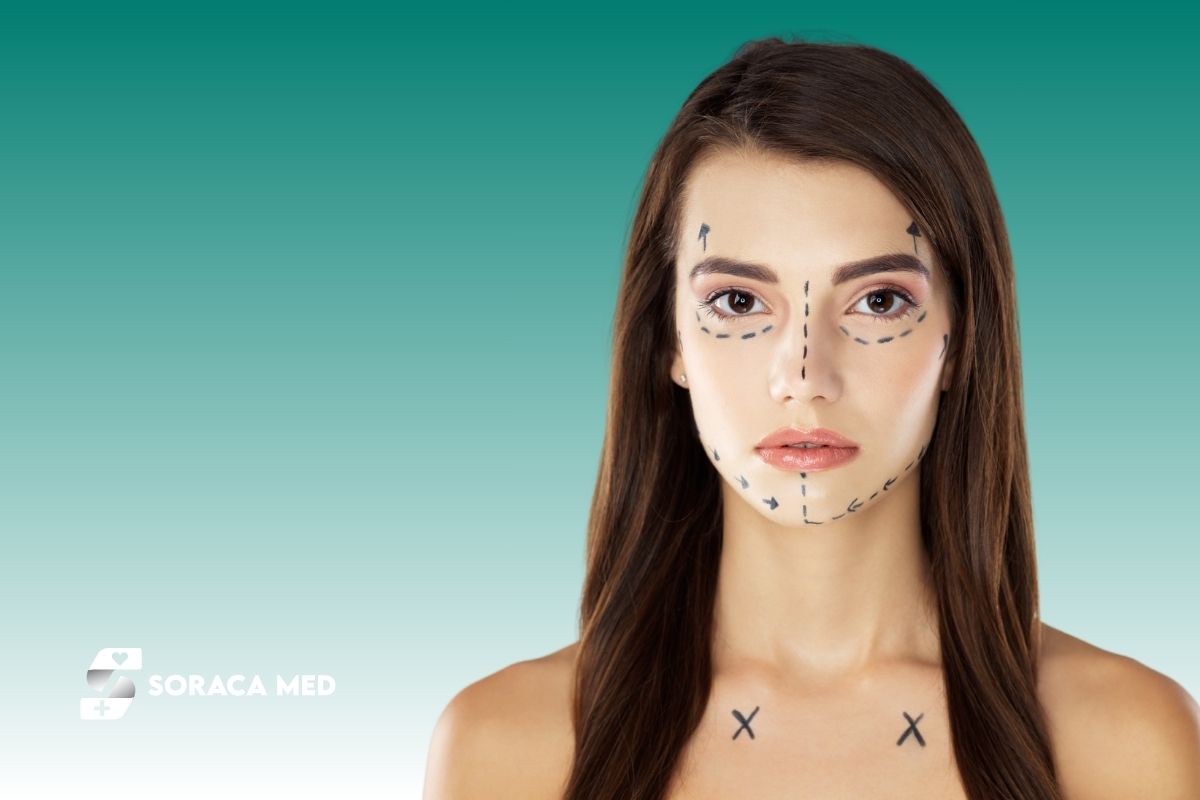 Blepharoplasty in Turkey