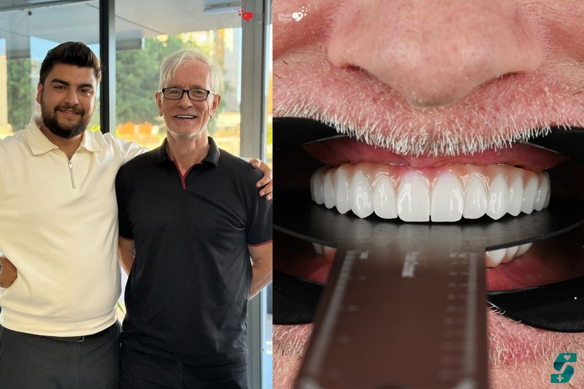 Dental Crowns Cost in Antalya