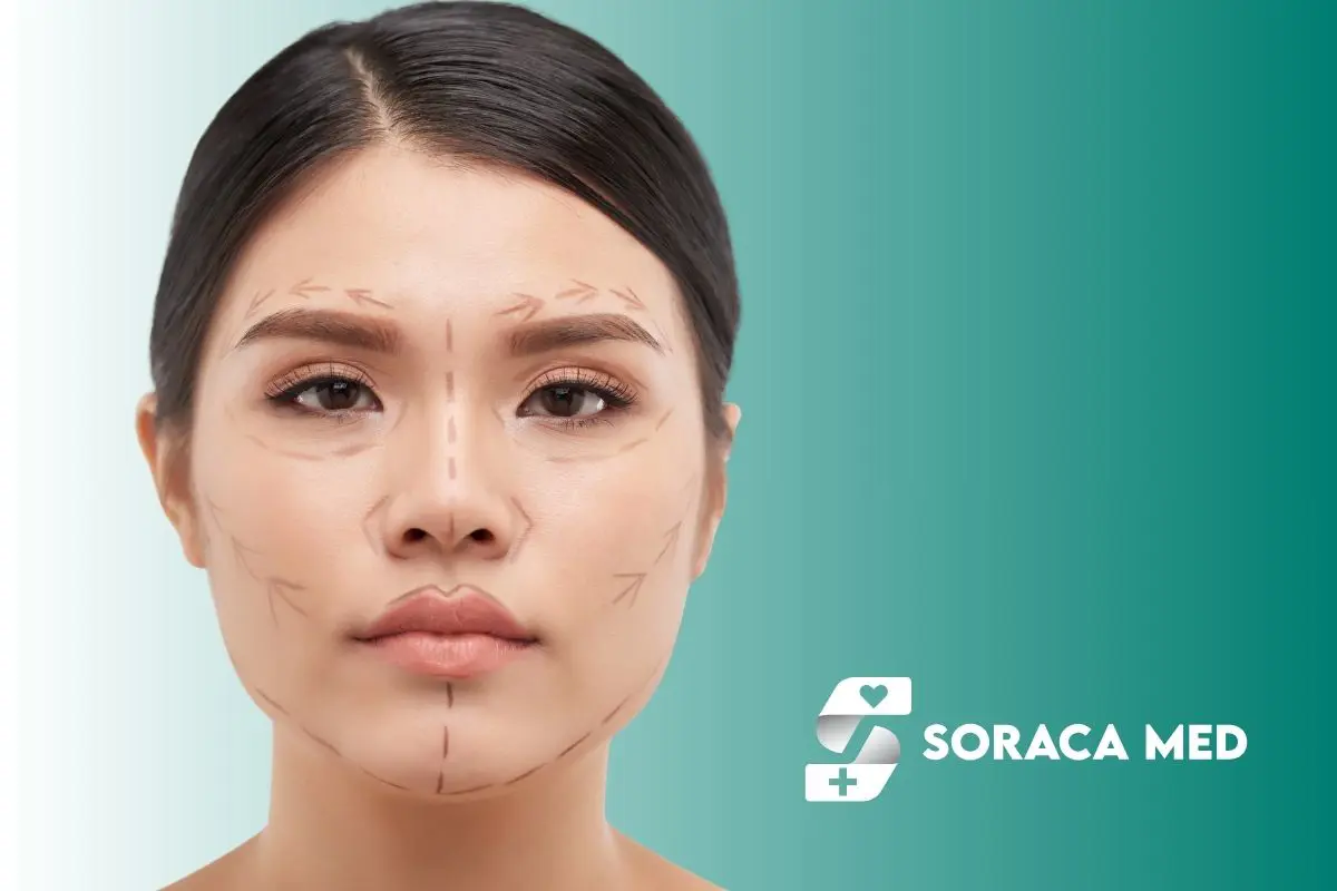 Forehead Lift Techniques