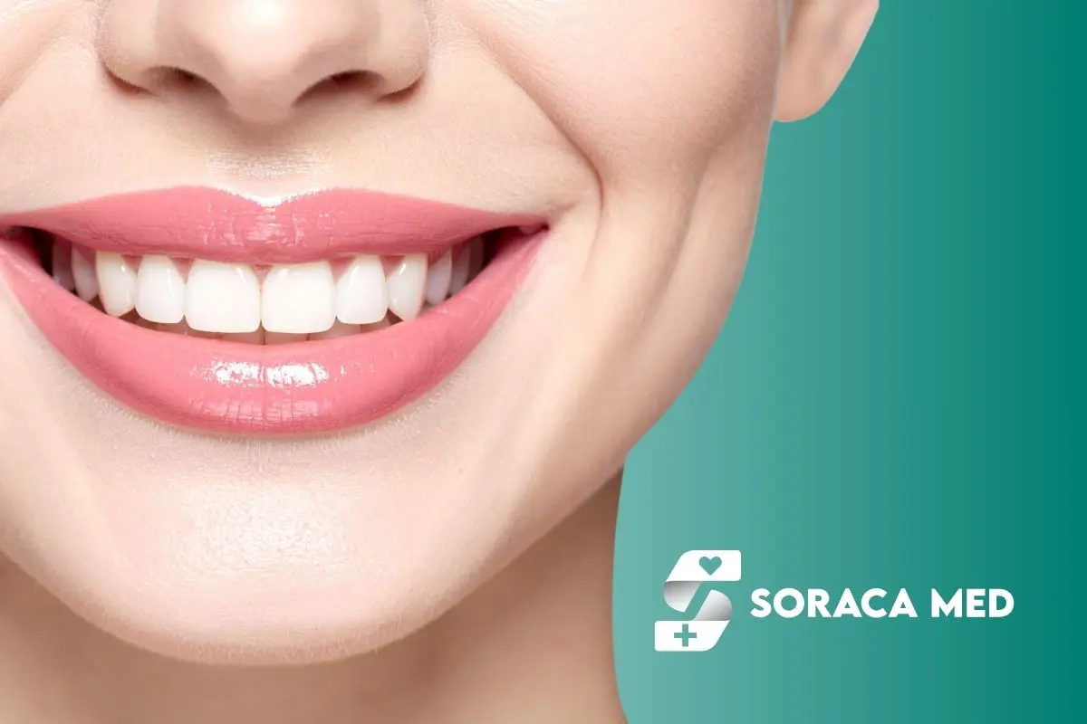 Ile Kosztują Licówki W Antalyi