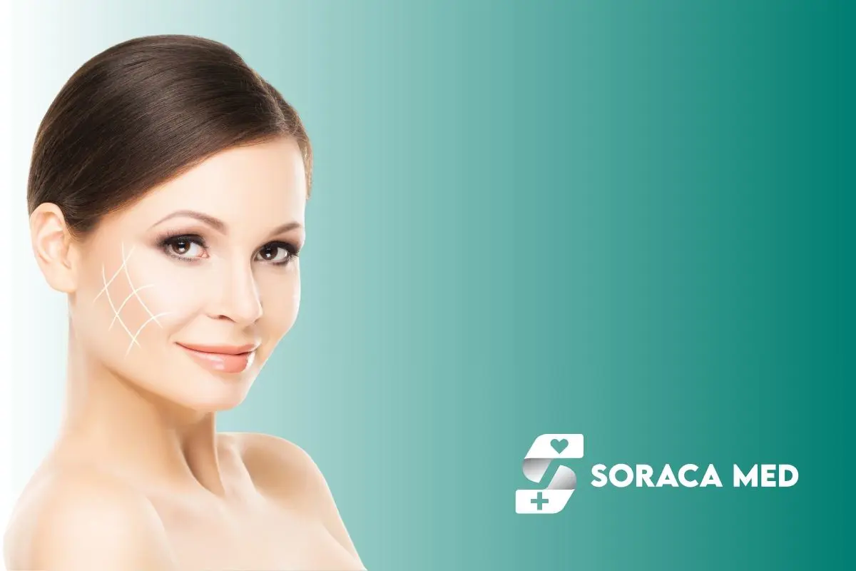 Kodėl Mini Facelift