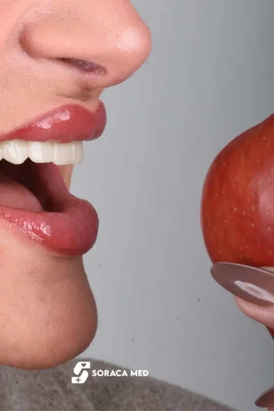 Opinie O Licówkach Dentystycznych