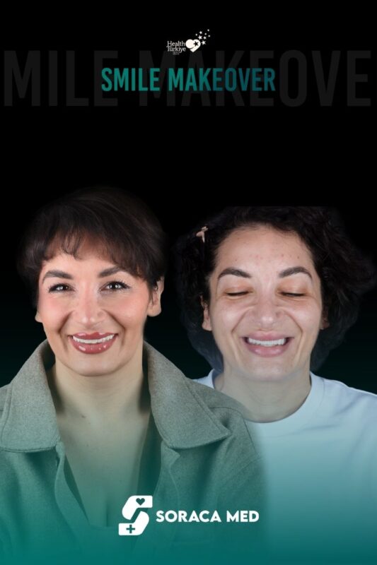 Real Patients All On Four Dental Implants