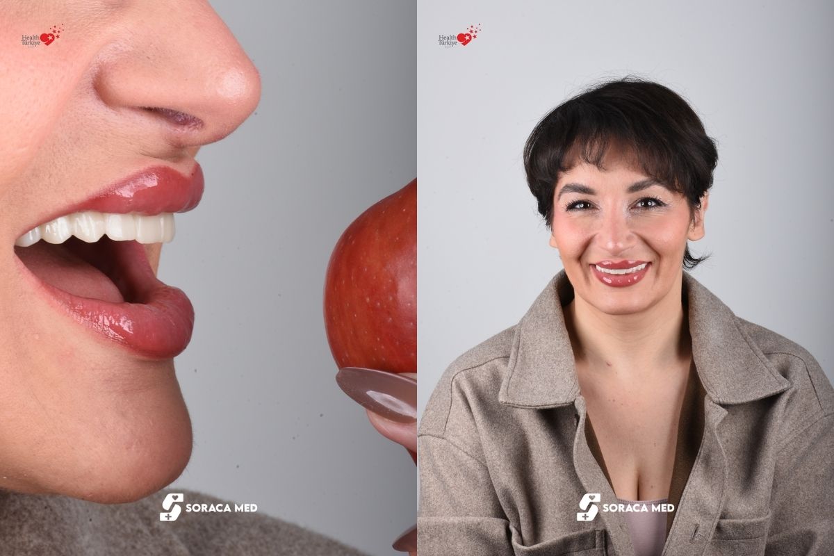 All on four dental implants in Antalya Soraca Med