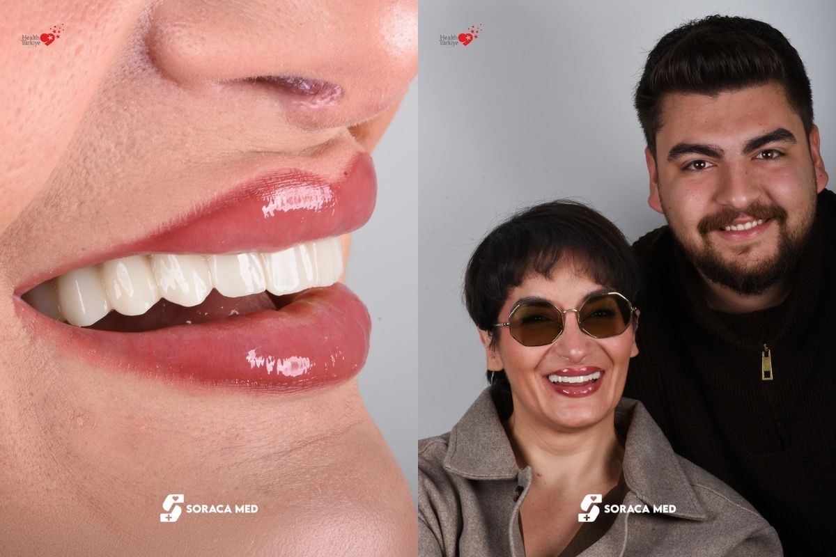 Dental Implants Near Me