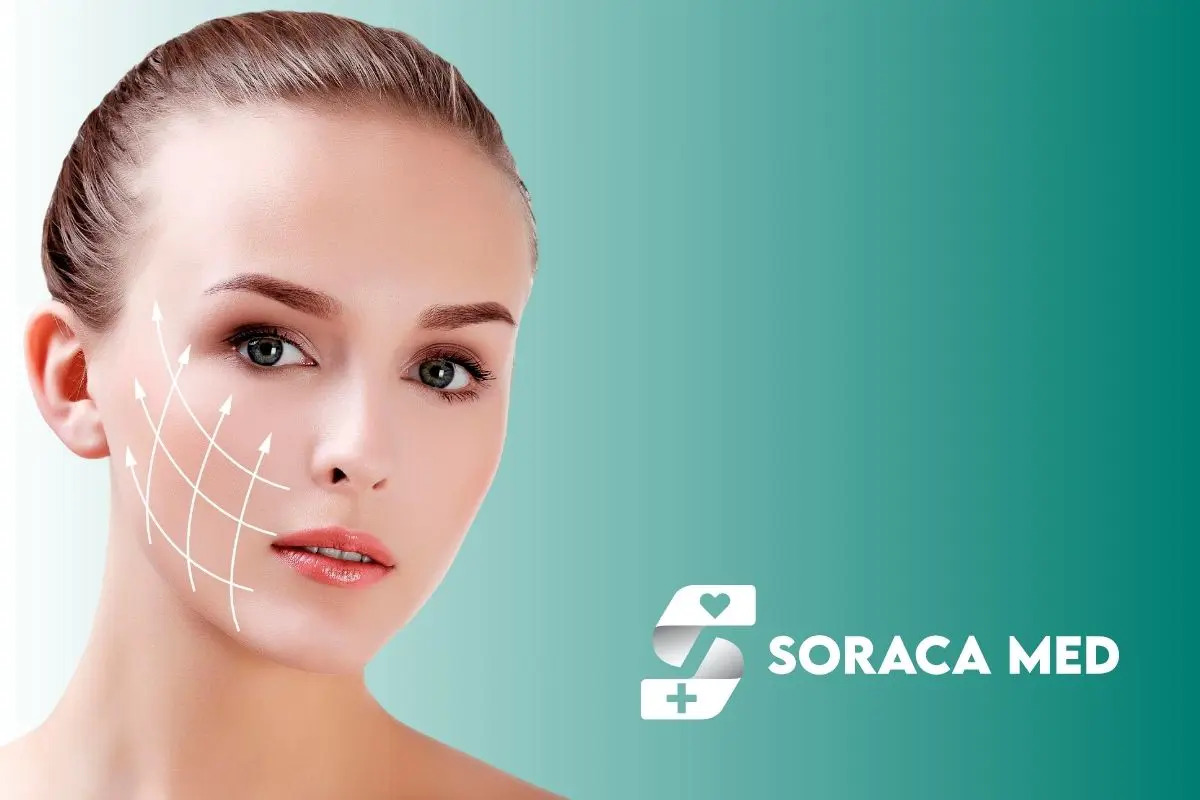 Antes Y Después Del Lifting Facial