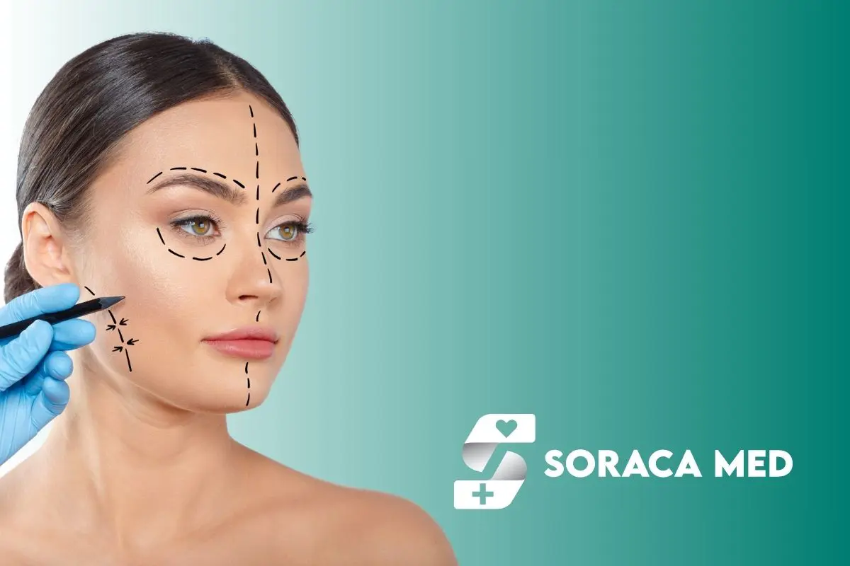 Canthoplasty Cost In Turkey