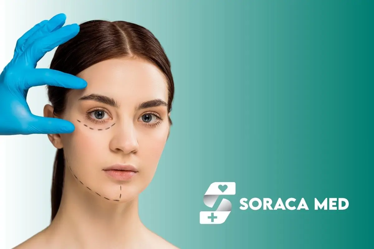 Canthoplasty Cost in Turkey