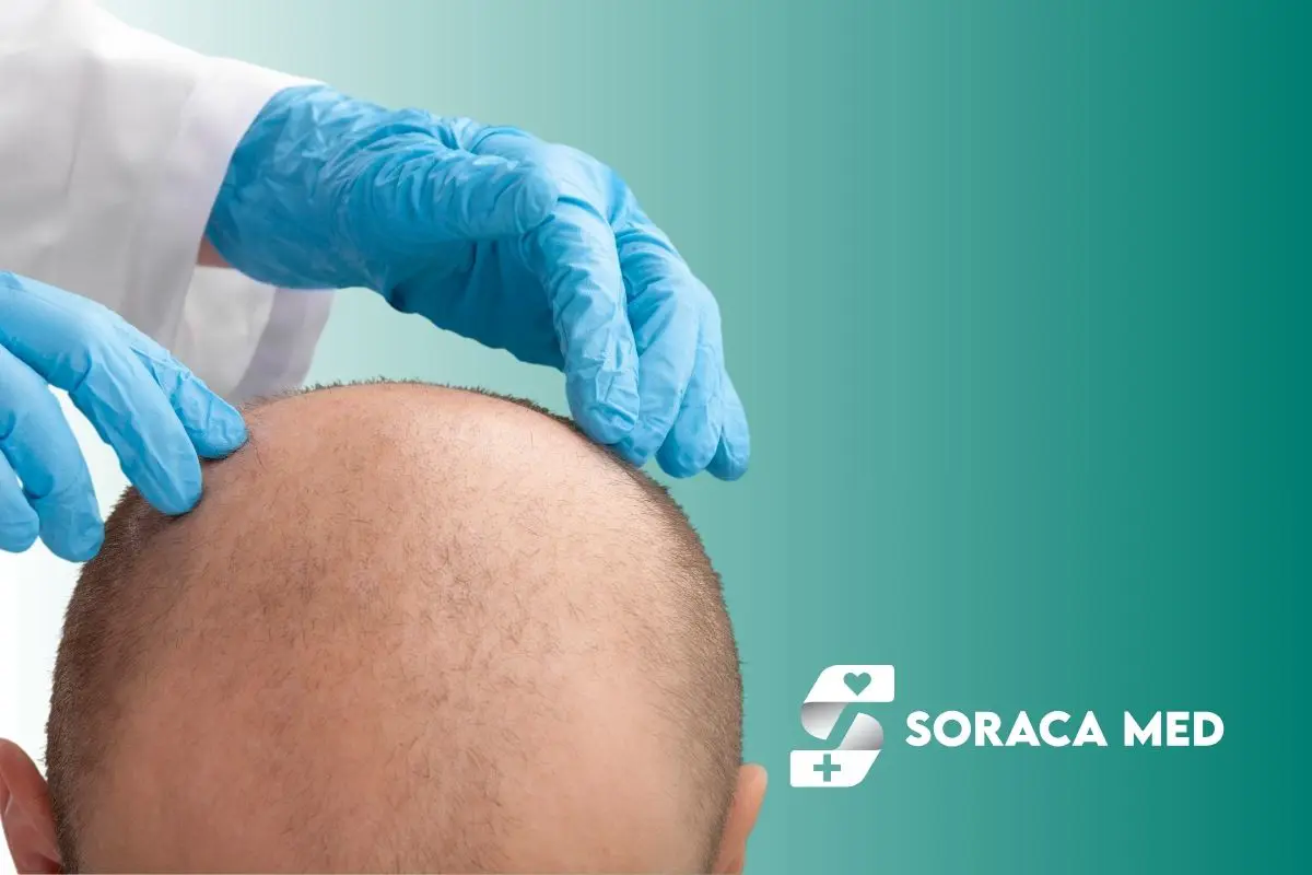 Haartransplantation Schritt Für Schritt