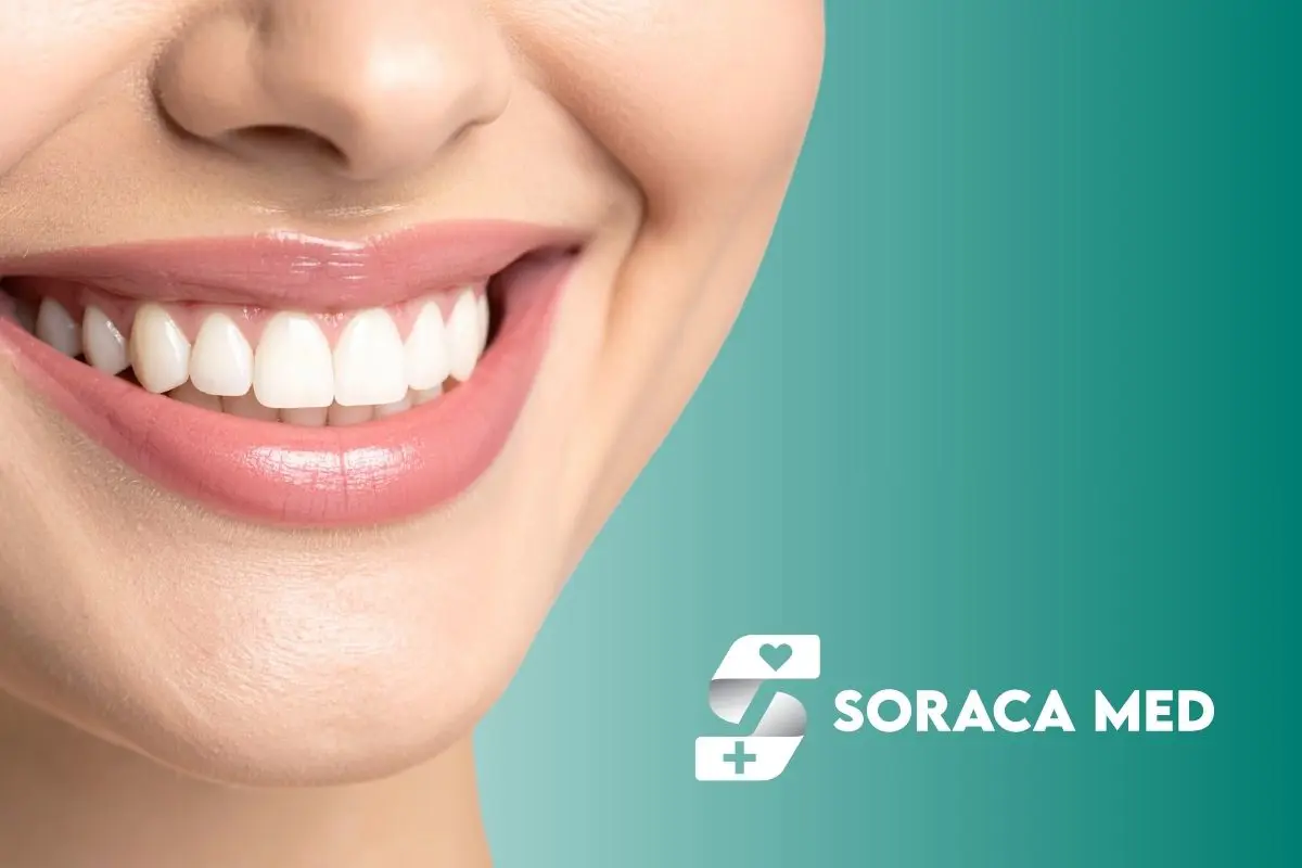 Implanturi zigomatice în Antalya