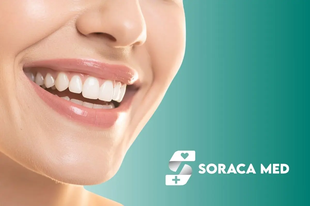 Implanty zębów w Turcji cena – ile naprawdę kosztuje leczenie w 2026 roku? 1 Implanty Zębów W Turcji Cena Vs Uk