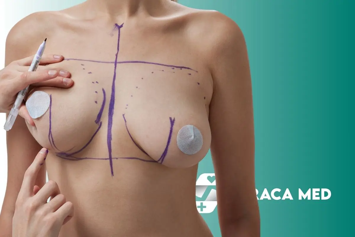 Lifting piersi w Turcji