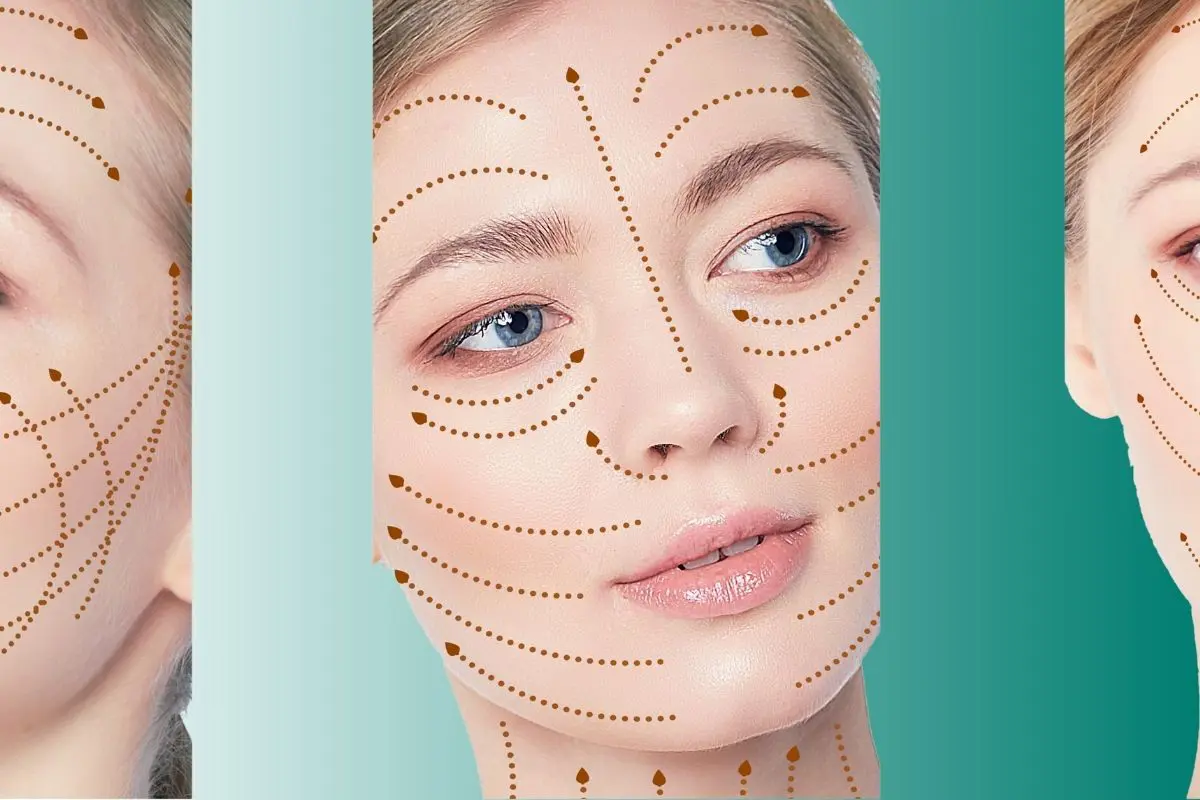 Precio Del Lifting Facial En Turquía