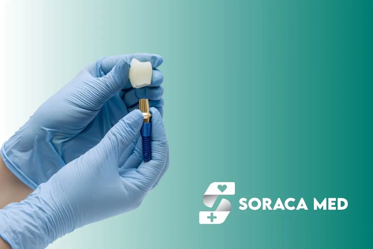 Dental Implants Cost in Hungary (2026 Prices & Turkey Comparison) 2 Dental Implants Procedure