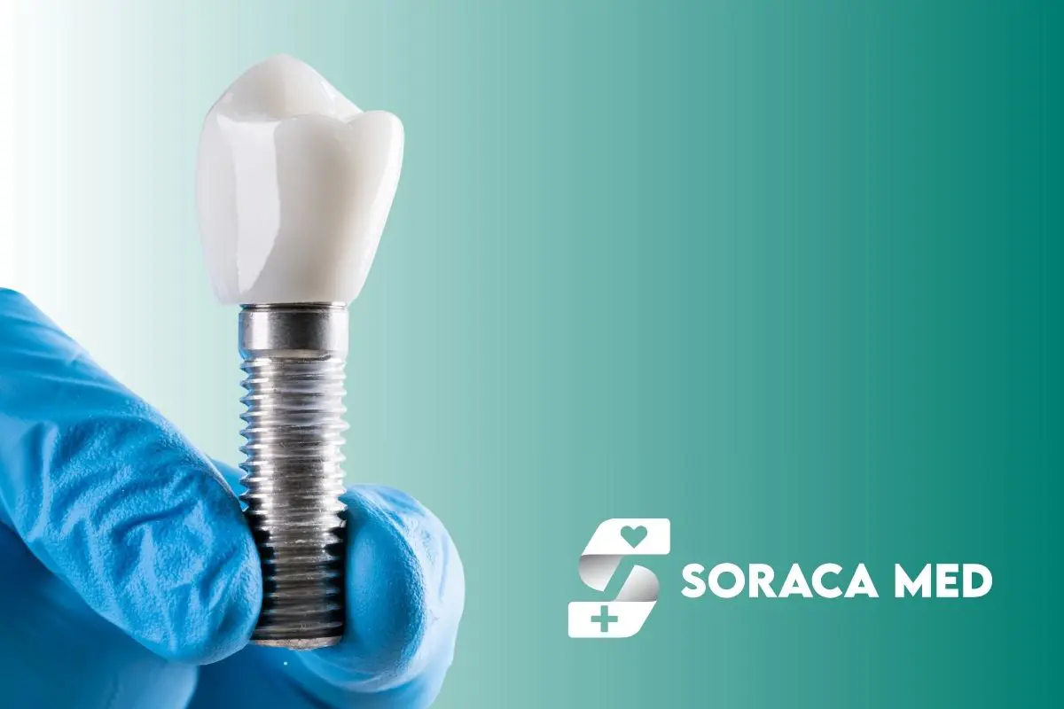 Dental Implants Cost in Hungary