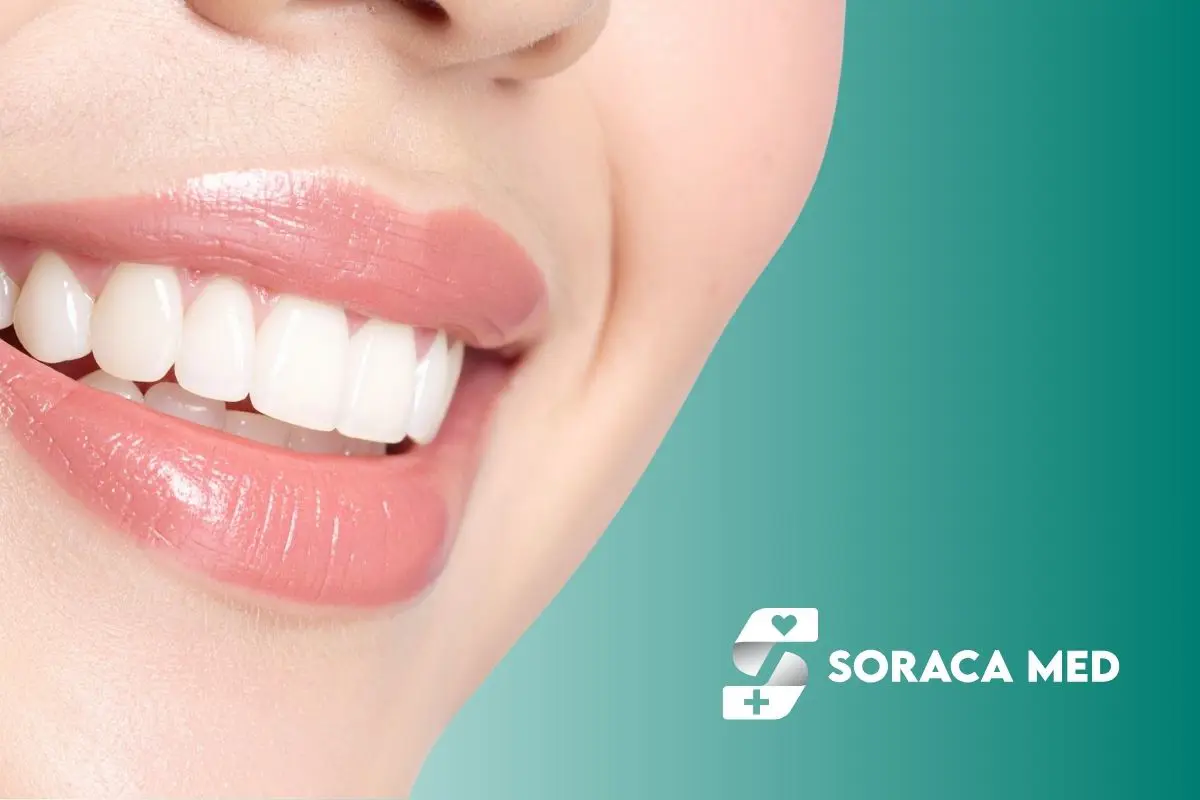 Dental Veneers Cost in Antalya 1 Dental Veneers Price Uk Vs Turkey