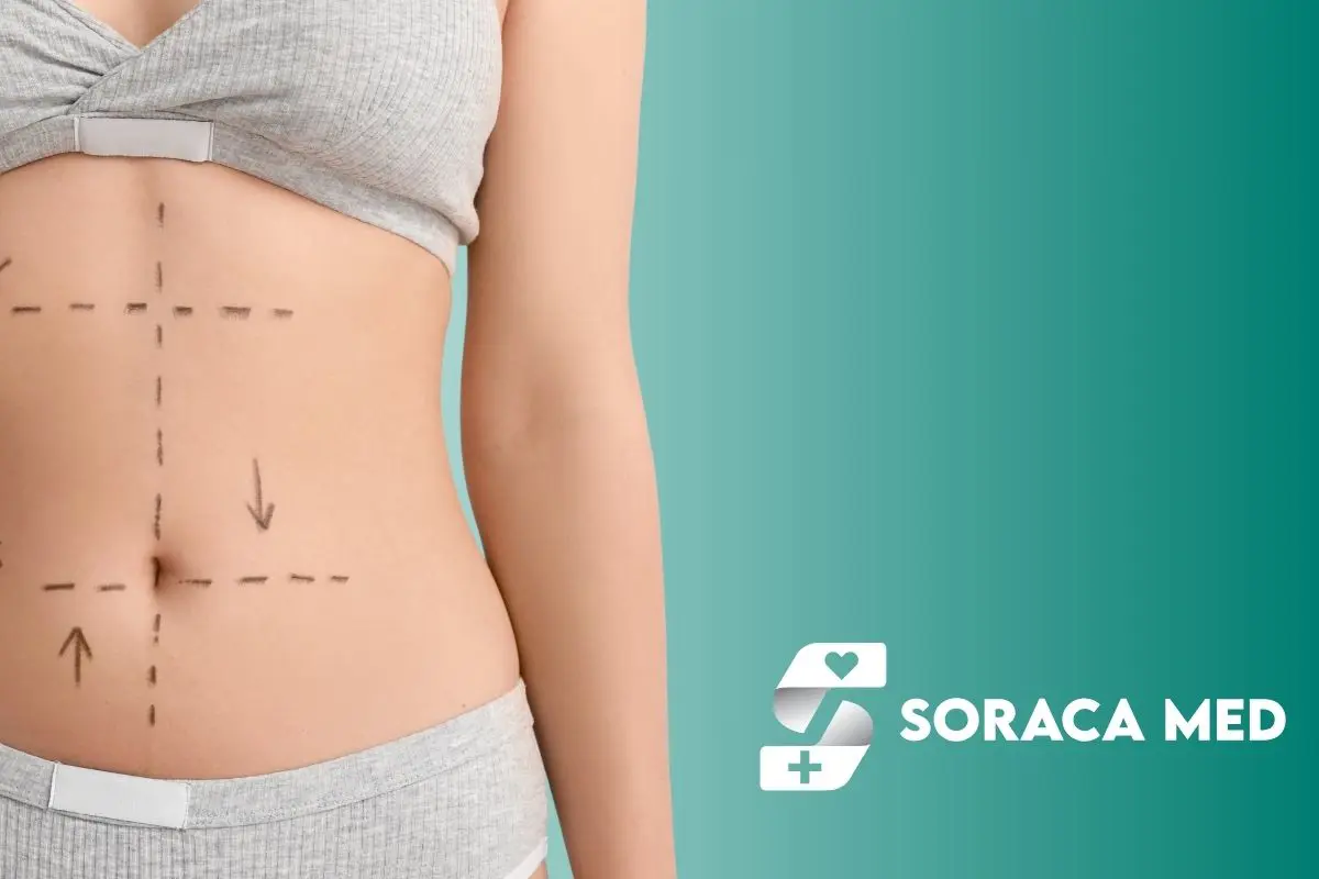 Addominoplastica Prezzo in Antalya, Turchia 1 L’intervento Di Addominoplastica