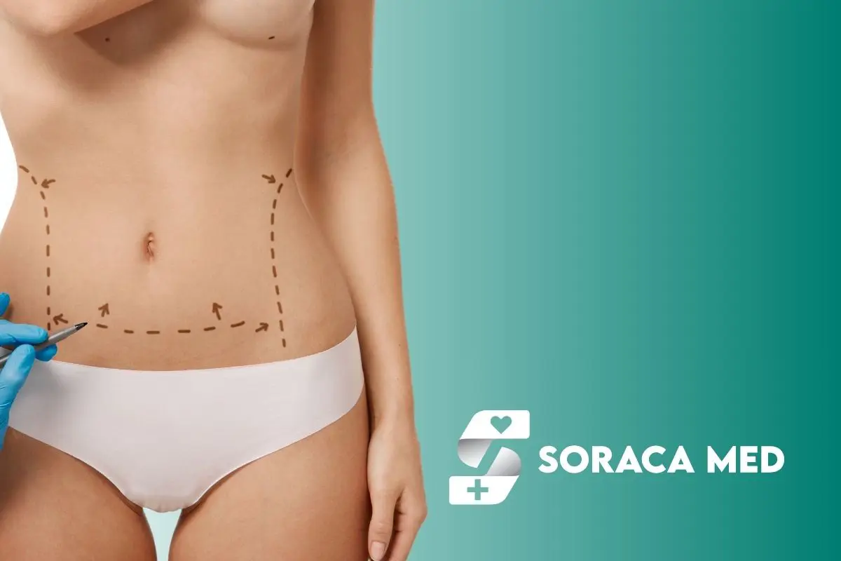 Abdominoplastia precio en Antalya